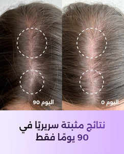 فييل هير سابورت image 3