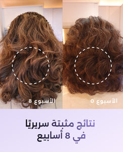 الفيتامينات المتعددة مالتي فيتامين image 3