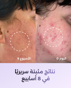 الفيتامينات المتعددة مالتي فيتامين image 8