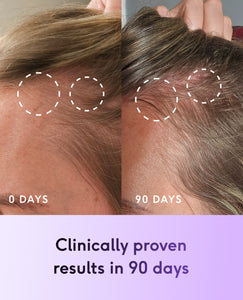 Feel Hair Support image 8