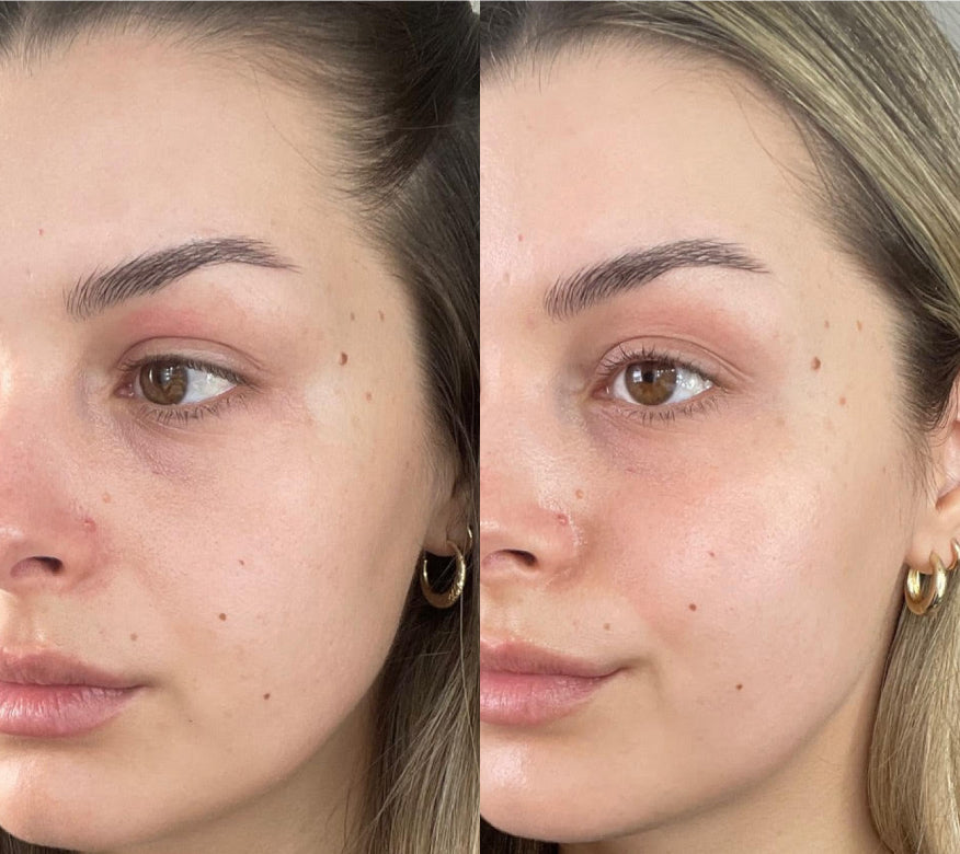 Feel Pro Collagen Peach Feel Wellness, Reimagined