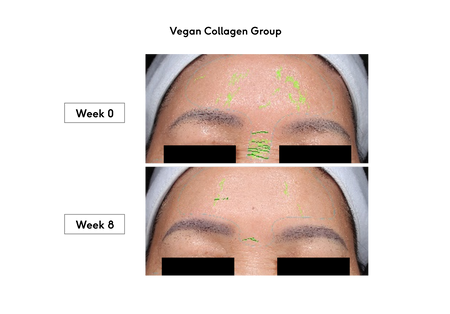 Clinical trial before after