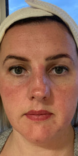 Customer results – before