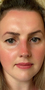 Customer results – after