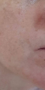 Customer results – before