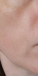 Customer results – after