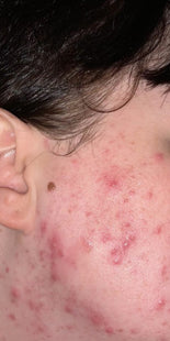 Customer results – before