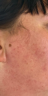 Customer results – after