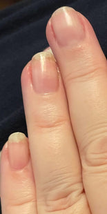 Customer results – before